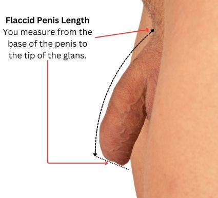 Flaccid penis length measured from the pubic area to the tip of the penis.
